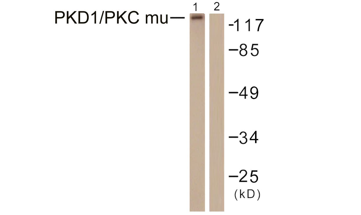 PRKD1 / PKC Mu Antibody (aa429-478)