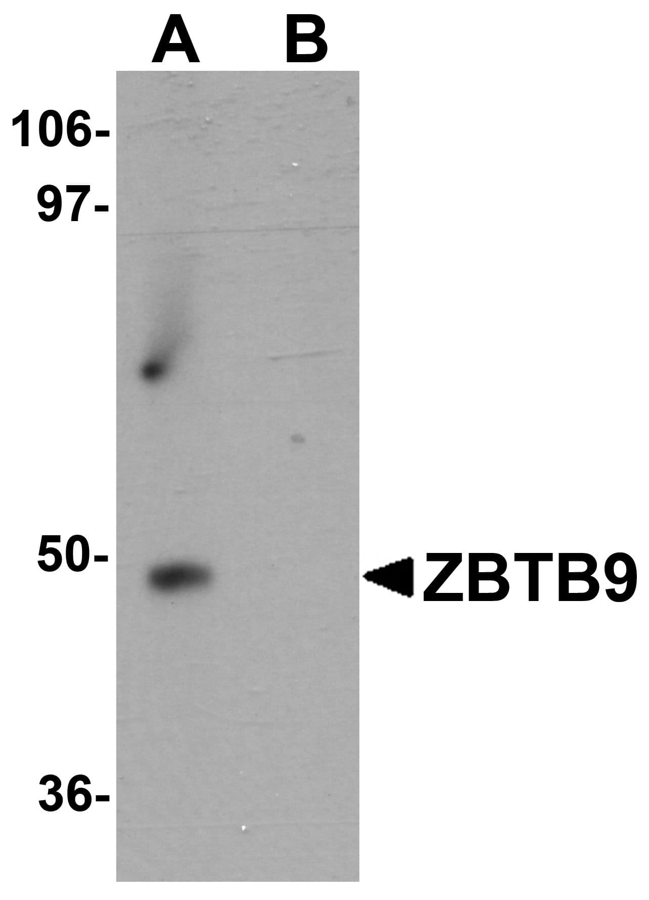 Polyclonal Rabbit anti-Human ZBTB9 Antibody (IHC, IF, WB)