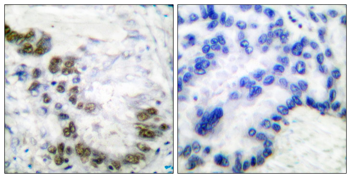 ATF2 Antibody (p51/53)
