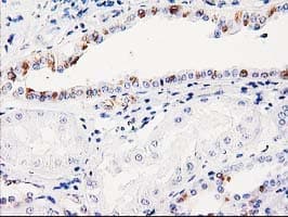 Monoclonal Mouse anti-Human ABRI / ITM2B Antibody (clone OTI1C11, IHC, WB)