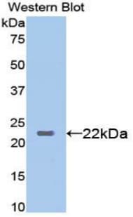 Leptin Antibody (aa22-167)