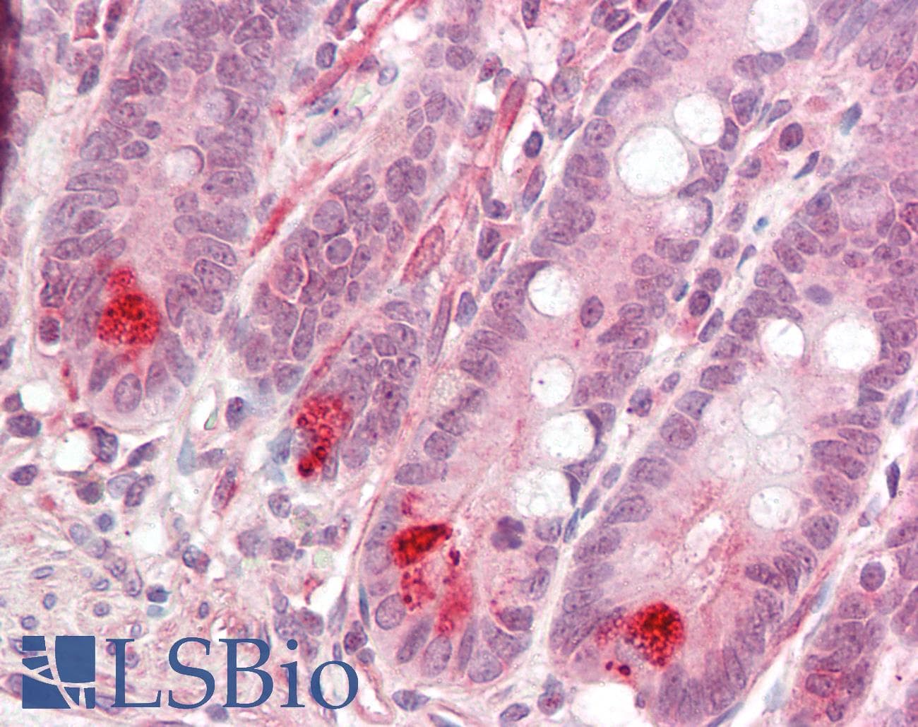 IHC-plus™ MLIP Antibody