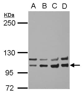 Polyclonal Rabbit anti-Human INSR / Insulin Receptor Antibody (IHC, WB)