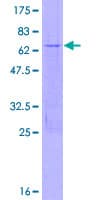 Human MBD3 Protein (Recombinant GST)