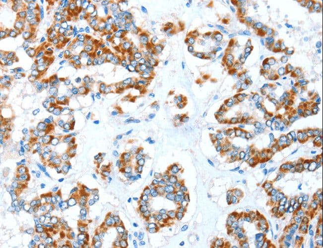 ALDH5A1 Antibody