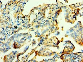 Polyclonal Rabbit anti-Human MYOT / Myotilin Antibody (aa443-498, IHC)