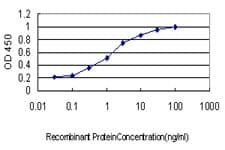 BP1 / DLX4 Antibody (clone 1F11)