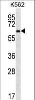 ZNF623 Antibody (aa506-535)