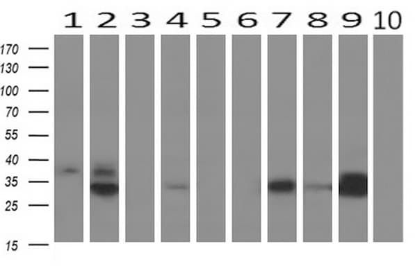 EPCAM Antibody (clone UMAB132)