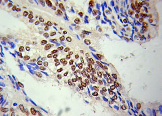 Polyclonal Rabbit anti-Human HDAC1 Antibody (IHC, WB)