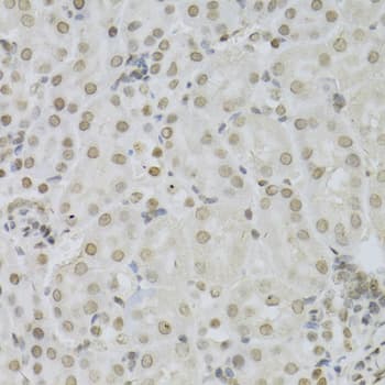 Polyclonal Rabbit anti-Human MAPK3 / ERK1 Antibody (IHC, IF, WB)