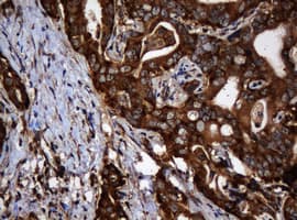 PAI-RBP1 / SERBP1 Antibody (clone OTI2E11)