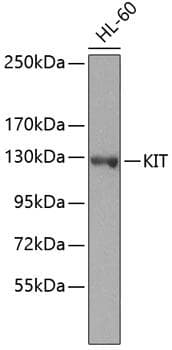 c-Kit / CD117 Antibody