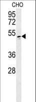 WBSCR16 Antibody (aa15-44)