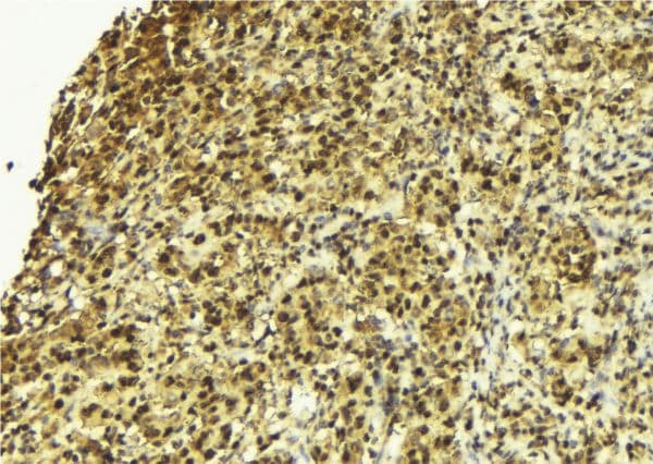 HDGFRP2 Antibody