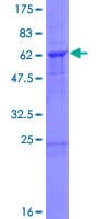 Human UFD1L Protein (Recombinant GST)