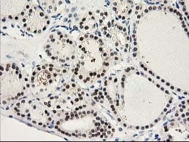 PRMT2 Antibody (clone OTI3A3)
