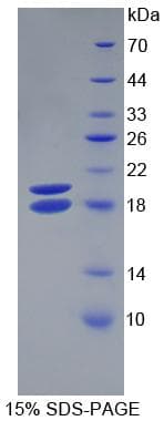 Rat NRG1 / Heregulin / Neuregulin Protein (Recombinant His)