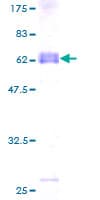 Human TEX264 Protein (Recombinant GST)