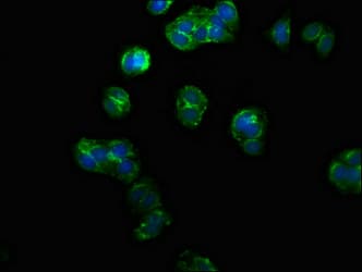 Polyclonal Rabbit anti-Human PPM1F Antibody (IHC, IF, WB)