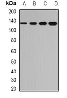 Polyclonal Rabbit anti-Human TPP2 Antibody (IHC, IF, WB)