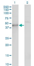 Monoclonal Mouse anti-Human CSNK1G1 / CKI-Gamma 1 Antibody (clone 3D1, IHC, WB)