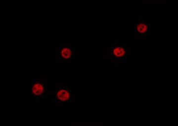 ZNF329 Antibody
