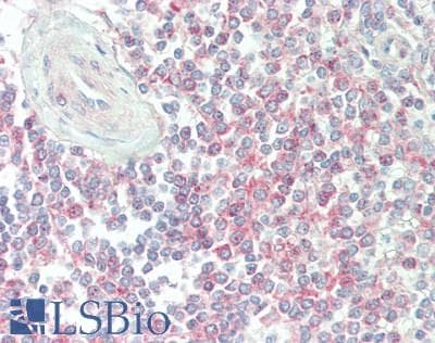 IHC-plus™ Polyclonal Goat anti-Human RENT1 / UPF1 Antibody (aa1075-C-term, IHC, WB)