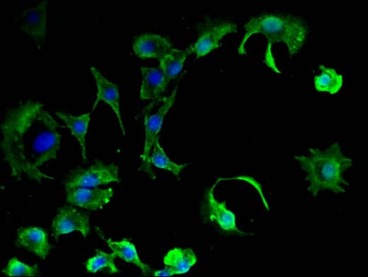Polyclonal Rabbit anti-Human PKIB Antibody (IHC, IF)