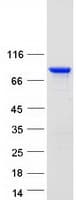 Human ENAH / MENA Protein (Recombinant Myc-DDK (Flag))