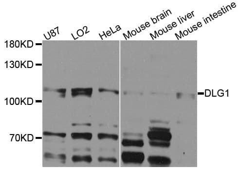 Polyclonal Rabbit anti-Human DLG1 / SAP97 Antibody (IHC, WB)