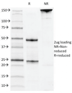 CD22 Antibody (clone MYG13)
