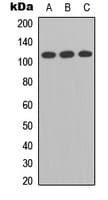 Polyclonal Rabbit anti-Human TMPRSS15 / Enterokinase Antibody (C-Terminus, WB)