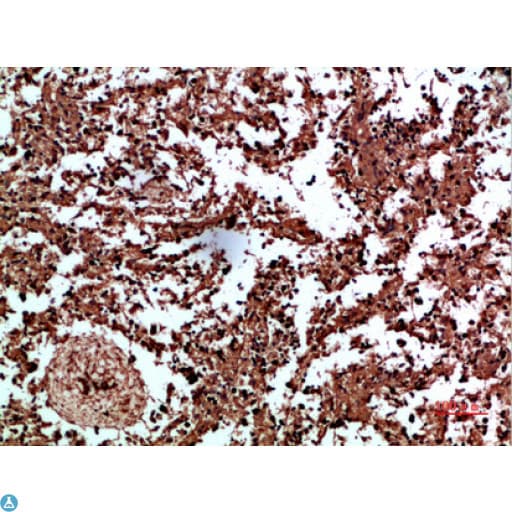 Polyclonal Rabbit anti-Human ANXA1 / Annexin A1 Antibody (IHC, WB)