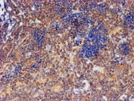 Monoclonal Mouse anti-Human FXYD3 Antibody (clone OTI1E8, IHC, IF, WB)