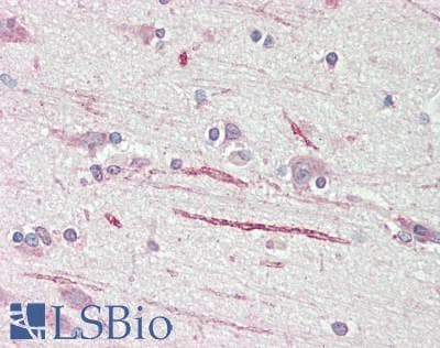 IHC-plus™ ASIC1 / ACCN2 Antibody