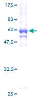 Human C1GALT1C1 Protein (Recombinant GST)