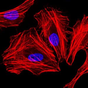 Monoclonal Mouse anti-Human C/EBP Alpha / CEBPA Antibody (clone 5B7, IHC, IF, WB)