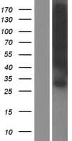 Human GJB1 / CX32 / Connexin 32 Protein (Over-Expression Lysate Myc-DDK (Flag))