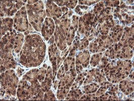PROSC Antibody (clone OTI1G2)