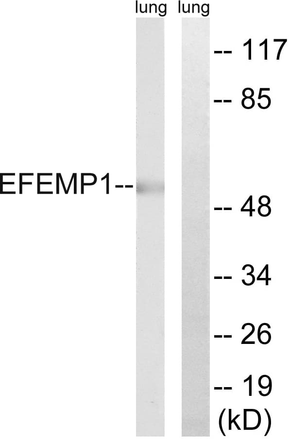 Fibulin-3 / EFEMP1 Antibody (aa111-160)