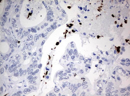 PBX1 Antibody (clone UMAB110)