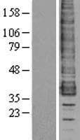 CCR1 Protein (Over-Expression Lysate Myc-DDK (Flag))