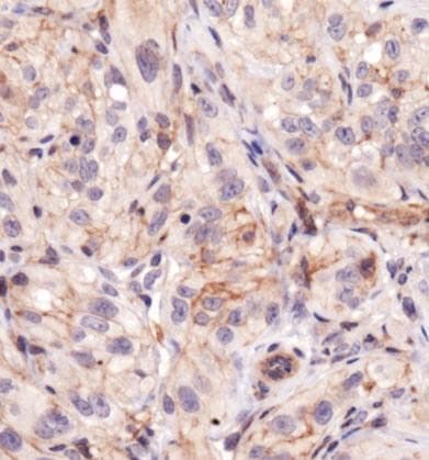 BTK Antibody (phospho-Tyr223, DY650)