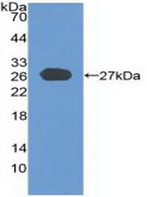 CYLD Antibody (aa170-338)