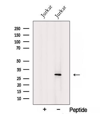 Polyclonal Rabbit anti-Human SNAP29 Antibody (WB)