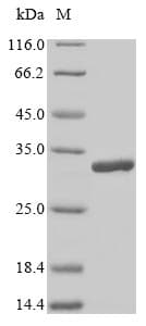 Rat LGALS3 / Galectin 3 Protein (Recombinant 6His, N-terminus)