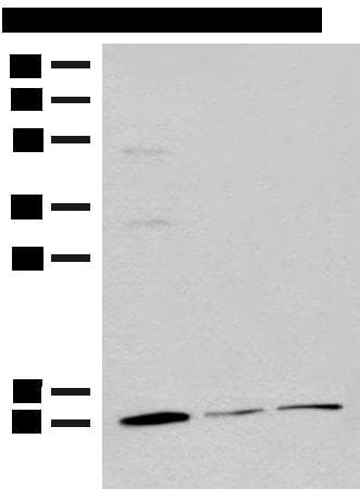 RPS27L Antibody
