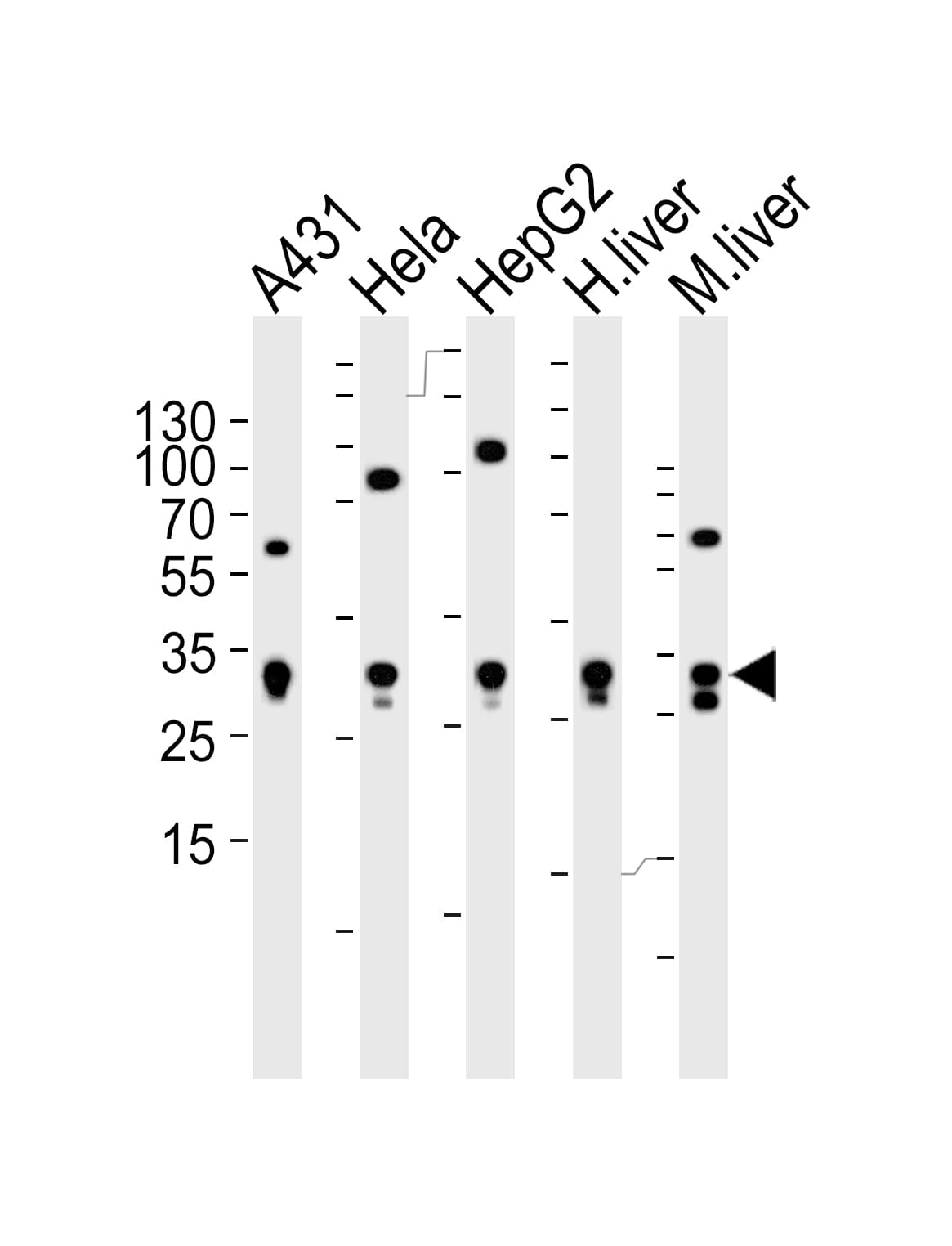 ETFA Antibody (aa192-226)