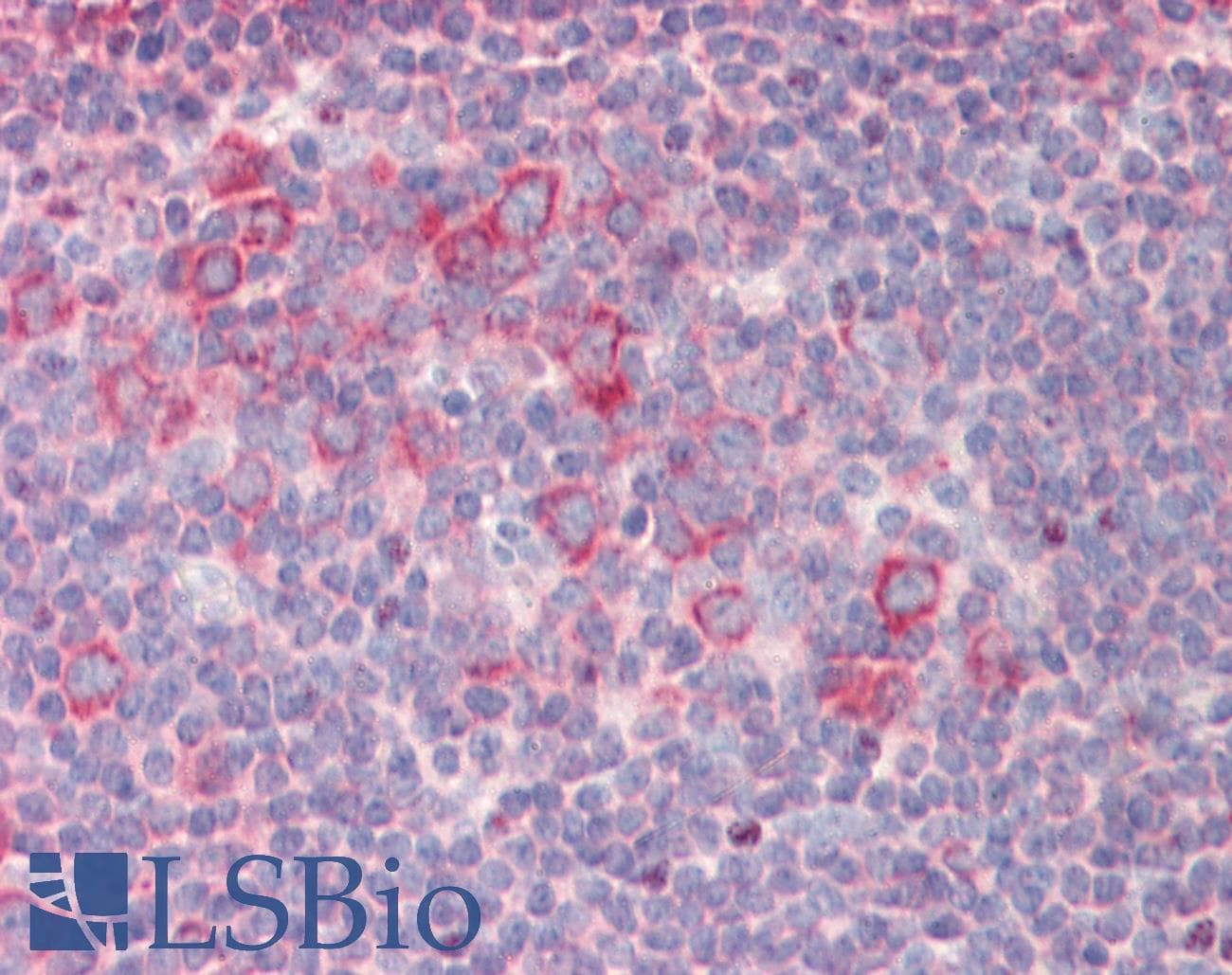 IHC-plus™ RPL23 / Ribosomal Protein L23 Antibody (aa123-135)